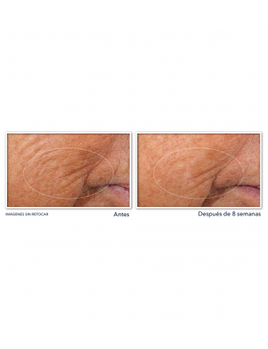 RETINOL CORREXION® Line...