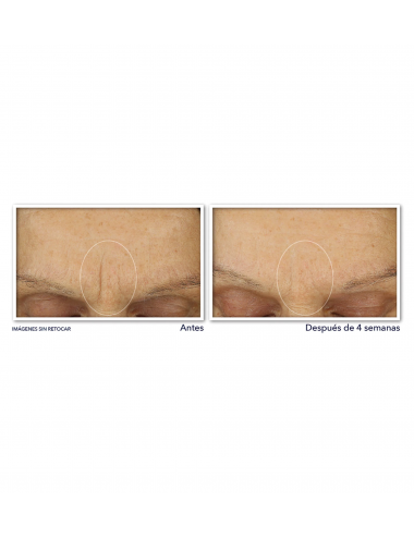 RETINOL CORREXION® Line...