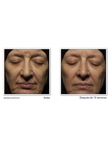 RETINOL CORREXION® Wrinkle...