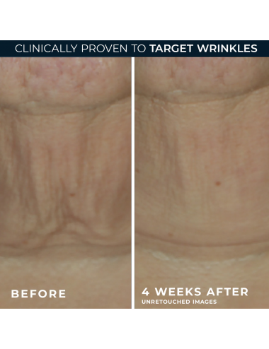 ROC DERM CORREXION FIRMING...