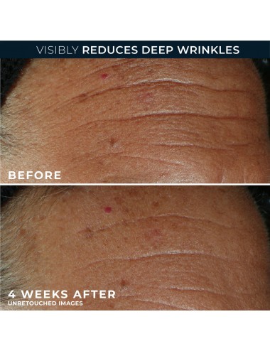 ROC DERM CORREXION FILL AND...