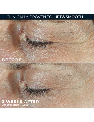 ROC DERM CORREXION DUAL EYE