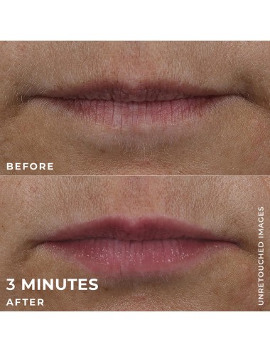ROC DERM CORREXION...