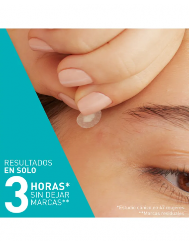 CERAVE PARCHES CONTROL...